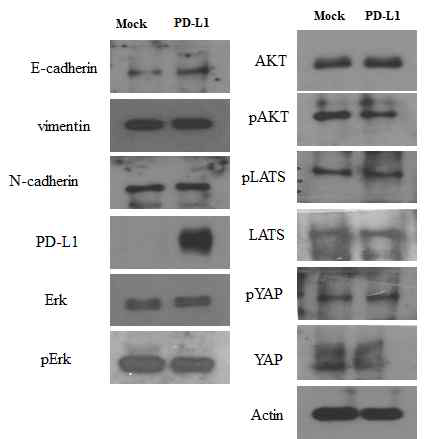 PD-L1 Stable 세포의 EMT, Erk와 AKT pathway, Hippo pathway의 확인