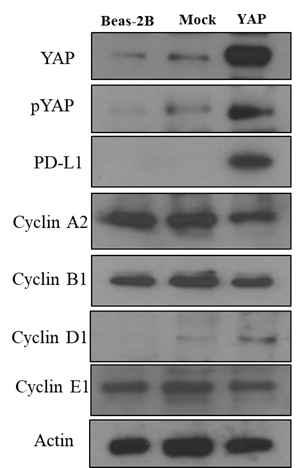 YAP 과발현시 PD-L1과 cyclin 발현 Western 분석