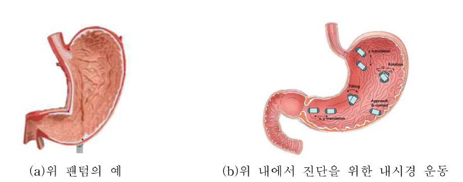 위 팬텀 및 진단의 예