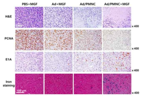 Ad/PMNC 나노 자성 복합체가 투여된 종양 조직의 면역조직화학적 분석