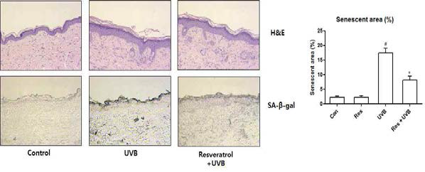 UVB에 의한 hairless mice skin의 senescence 증가와 resveratrol에 의한 억제