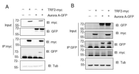 An interaction between TRF2 and Aurora kinase A. HEK293 cells were co-transfected with Myc-TRF2 and GFP-Aurora A. (A) Myc-tagged TRF2 was immunoprecipitated by anti-Myc antibody followed by immunoblotting with anti-GFP antibody. (B) GFP-Aurora kinase A was immunoprecipitated (IP) by anti-GFP antibody followed by immunoblotting with anti-Myc antibody