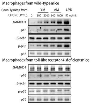 Effect of fecal lysates from young (YM) or aged mice (AM) on the expression levels of SAMHD1 and the senescence marker p16 and activation of NF-kB in macrophages