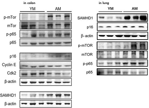 SAMHD1 and p16 expression in young (YM) and aged mice (AM)