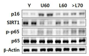 Effects of fecal LPS fractions of UTC (도시인; Y, >10; U60, 60-69Y) and LVC (장수촌인: L60, 60-69; L70, >70 on the expression of p16, SIRT1, p65, and β-actin in mouse macrophages