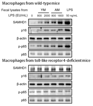 Effects of fecal lysates from young (YM) or aged mice (AM) on the expression levels of SAMHD1 and the senescence marker p16 and activation of NF-kB in macrophages