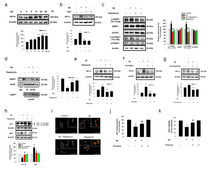 아밀로이드 베타의 mTOR 활성화 효과를 통한 HIF1α 합성 촉진 및 자가소화억제 효과