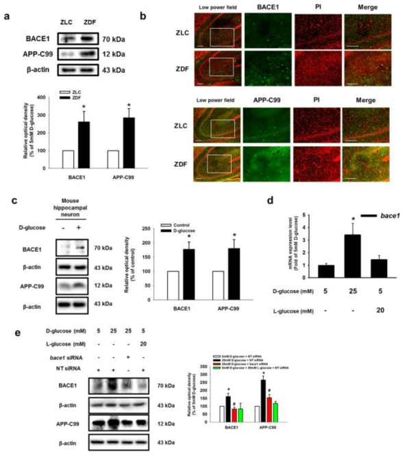 고농도 포도당이 당뇨병 랫트 모델, 마우스 해마 신경세포, 신경세포주에서 BACE1 발현에 미치는 영향