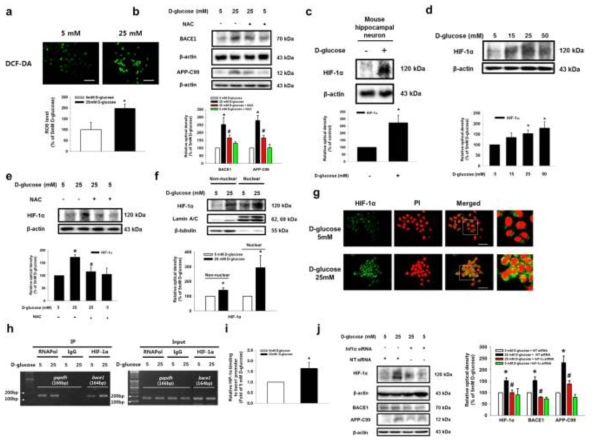 고농도 포도당에서 BACE1 발현에 활성산소종에 의한 유도된 HIF-1α의 역할