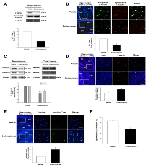 Glucocorticoid가 수컷ICR 마우스 해마 미세소관 불안정화에 미치는 영향