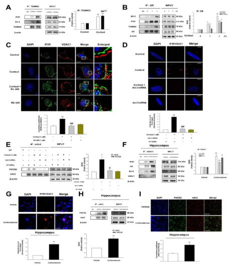 마우스 해마 및 SH-SY5Y세포에서 GR-Bcl-2 복합체가 ER과 미토콘드리아 결합에 미치는 영향 연구