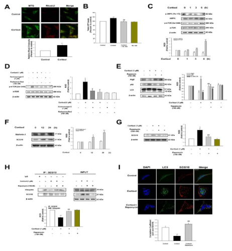 SH-SY5Y세포에서 Glucocorticoid가 autophagy 억제와 이에 따른 SCG10 발현에 미치는 영향 연구