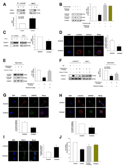 Glucocorticoid가 미세소관 불안정화와 세포내 수송 저해에 미치는 영향 연구