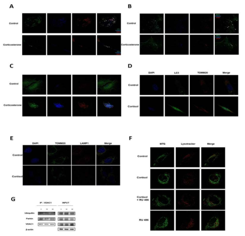 Glucocorticoid가 마우스 해마세포 및 SH-SY5Y 세포주에 미치는 영향 연구