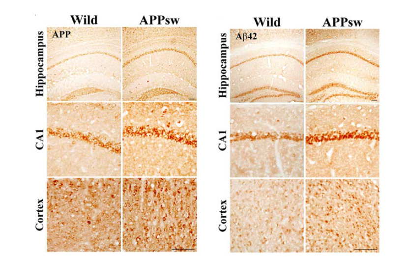 생후 1년된 NSE/APPsw transgenic mice의 신경원세포 특이적 APP/Aβ 발현