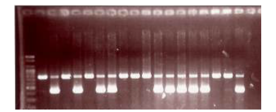 그림 6. Tg2576 mice의 genotyping (Single band: Wild, Double band: Tg2576)
