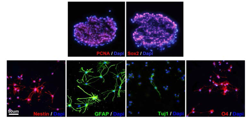 NSE/APPsw transgenic mice 유래 신경전구세포의 증식 및 분화특성