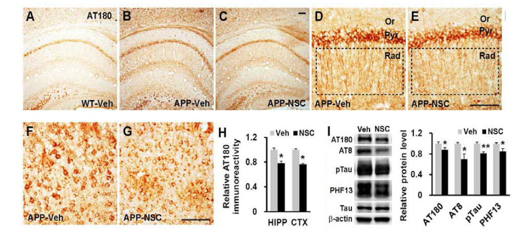 인간 신경전구세포 이식을 통한 알츠하이머병 동물모델의 과인산화 tau의 변화