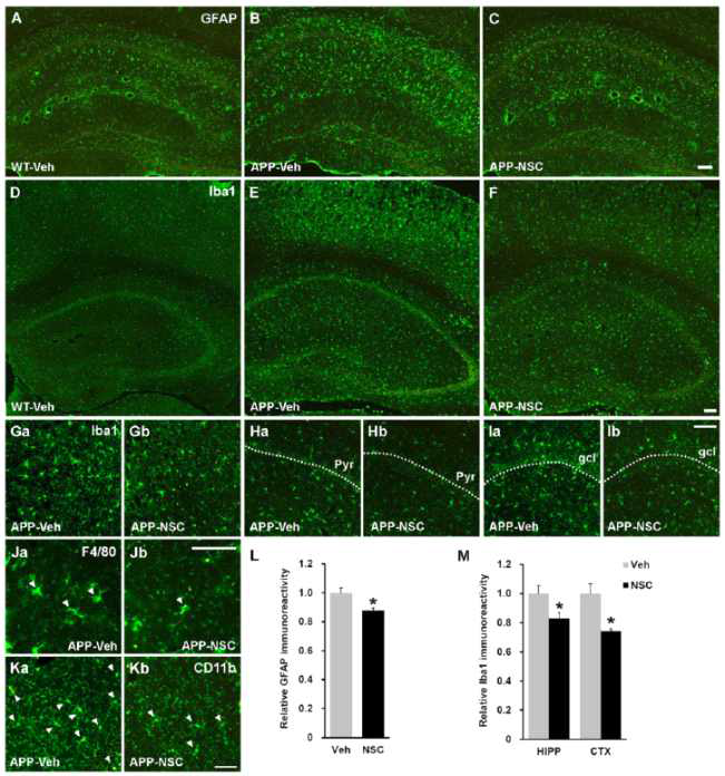 인간 신경전구세포 이식을 통한 알츠하이머병 동물모델의 염증반응 관찰