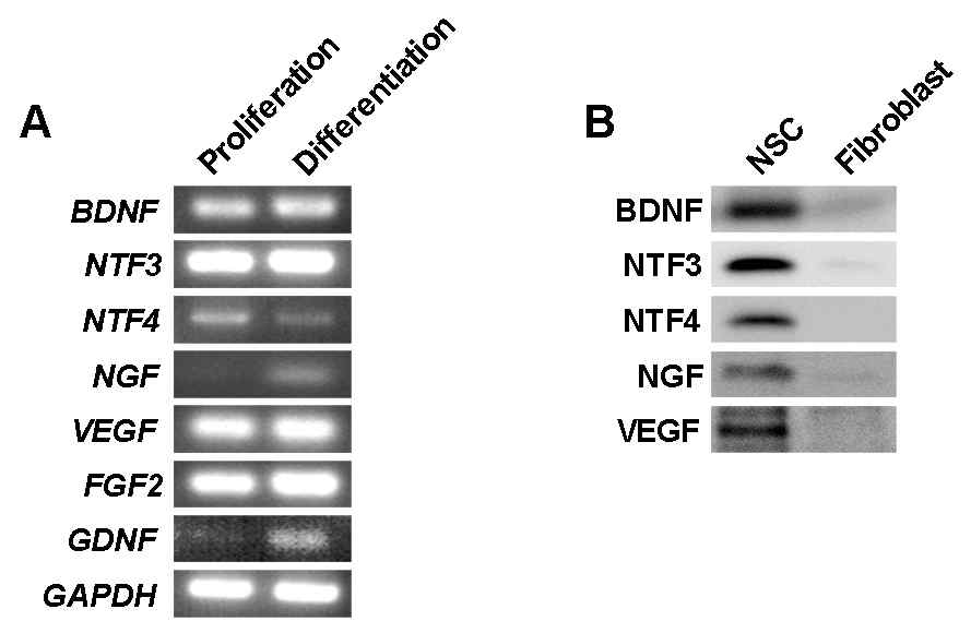 in vitro 인간 신경전구세포의 신경영양인자 발현 및 분비