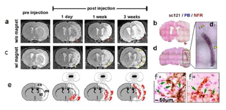 MRI 및 조직 염색을 이용한 자성나노입자 도입된 인간 신경전구세포의 생체 내 분포 측정