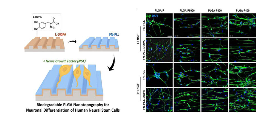 생분해성 폴리머를 이용한 인간 신경전구세포의 분화 및 outgrowth