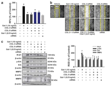 Gal-1에 의하여 감소된 COL-3와 COL-5의 발현이 줄기세포의 이동에 미치는 효과