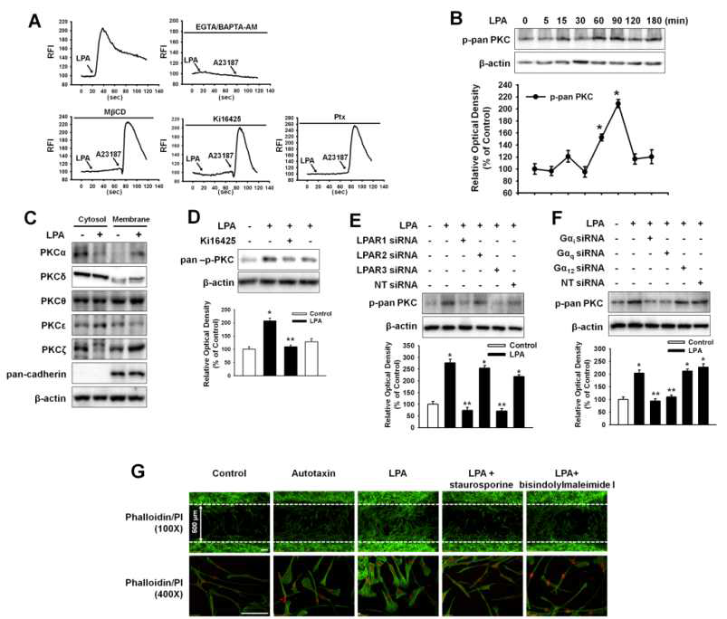 LPA에 의한 Ca2+/PKC 활성화가 세포 이동능 조절에 미치는 영향 분석