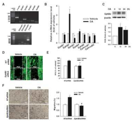 줄기세포의 EphB2 발현 조절에 대한 OA의 효과