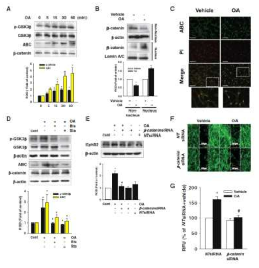 GSK-3β/β-catenin 신호전달기전과 연관된 OA의 EphB2 발현 조절