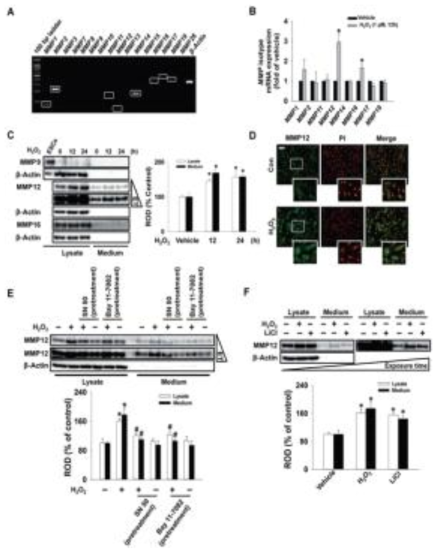 MMP12의 발현과 분비에 대한 과산화수소의 효과