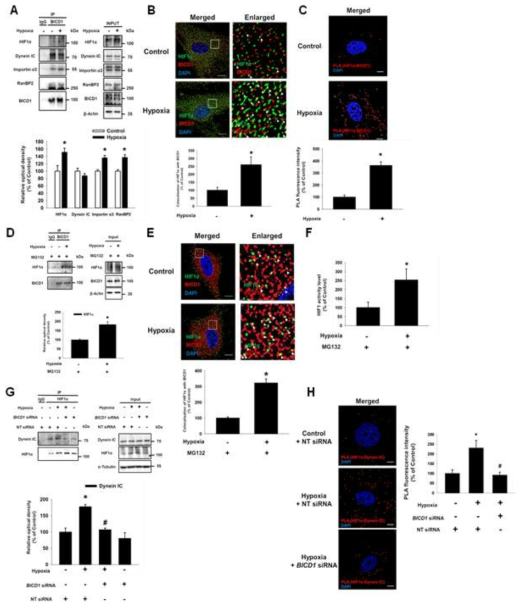 저산소 환경이 BICD1과 HIF1α간의 상호작용에 미치는 영향