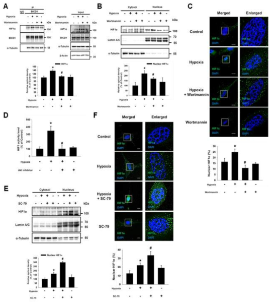 Akt 활성 조절이 BICD1 매개 HIF1α 핵내이동에 미치는 영향