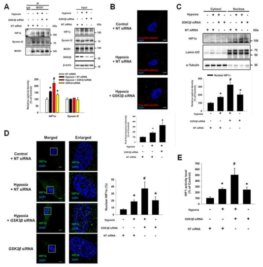 GSK3β 발현 억제가 BICD1 매개 HIF1α 핵내이동에 미치는 영향