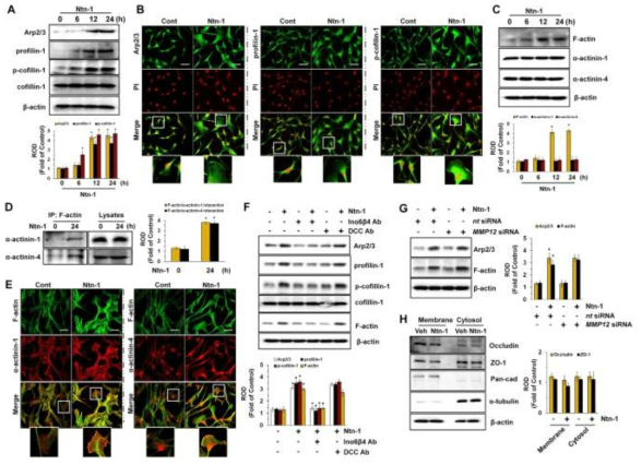 네트린의 SP1의 활성화와 VEGF 발현조절 효과