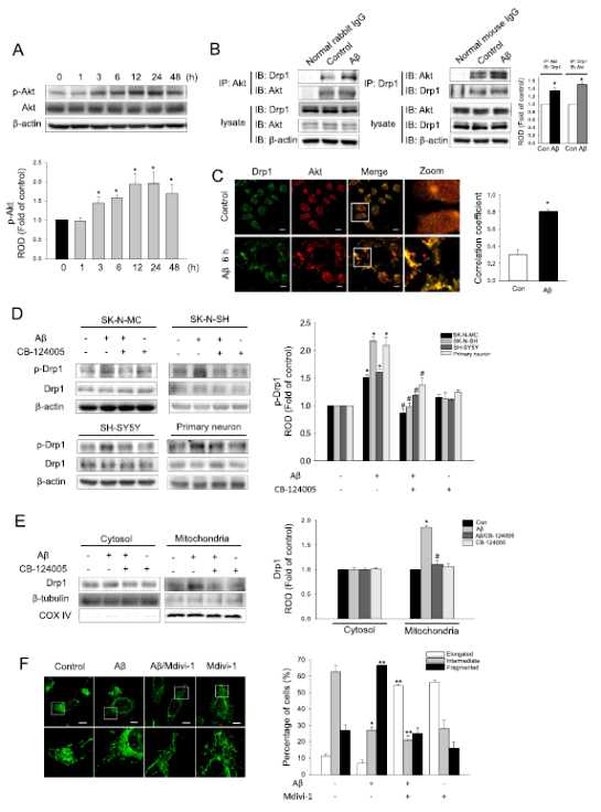 아밀로이드 베타에 의한 지속적인 Akt 활성화가 Drp1 인산화 조절에 미치는 영향