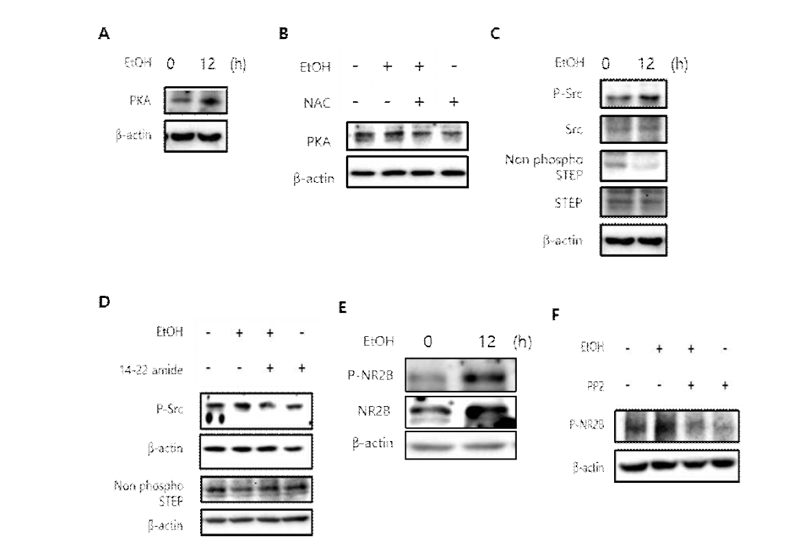 에탄올에 의하여 유도된 PKA활성과 NMDA 수용체 과활성을 유발 기전