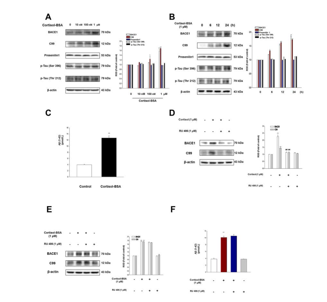 당질코르티코이드의 nongenomic 효과가 신경세포주에서 아밀로이드 베타 형성에 미치는 영향