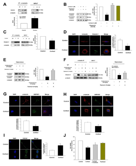 Glucocorticoid가 미세소관 불안정화와 세포내 수송 저해에 미치는 영향 연구