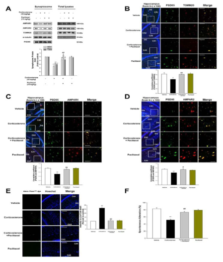 Glucocorticoid가 미세소관 불안정화에 따른 기억력 손상에 미치는 영향 연구