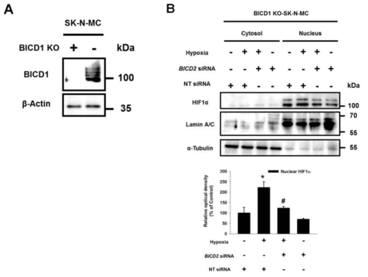 BICD1 유전자 교정 세포의 HIF1 핵내 이동 조절 및 허혈 적응 현상 규명