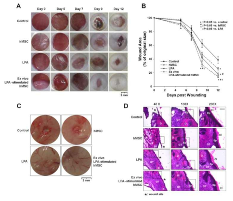 LPA와 줄기세포가 마우스 피부 상처 치유에 미치는 영향