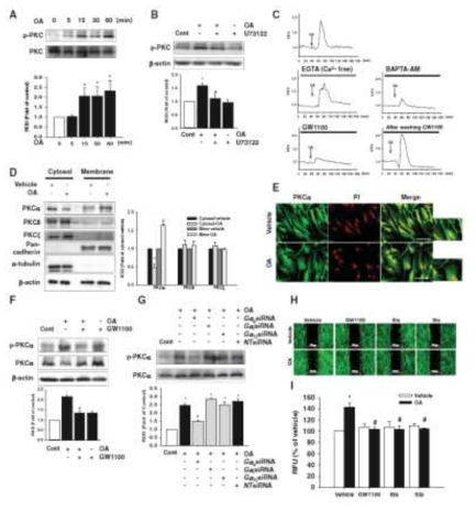 OA의 처리 시 GPR40 및 PKCα의 활성