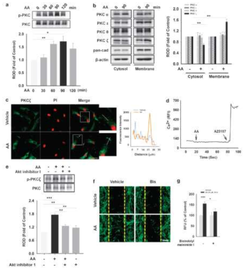 AA가 atypical PKCζ의 인산화에 미치는 영향 분석