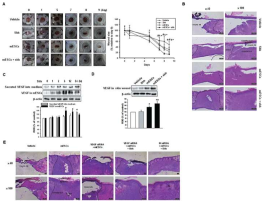 생체 내 피부상처치유에 있어서 shh와 줄기세포의 역할
