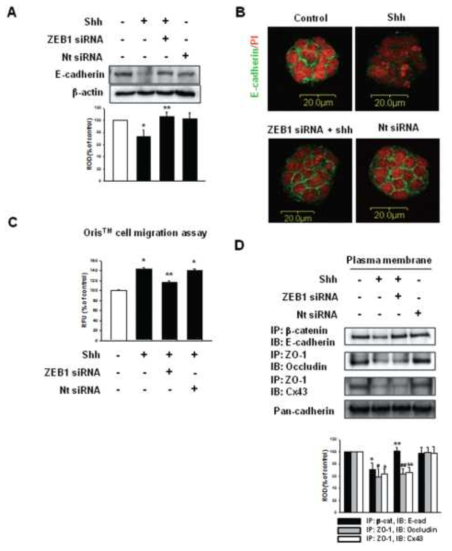 줄기세포의 이동능과 세포 간 연접에 있어 ZEB1의 역할