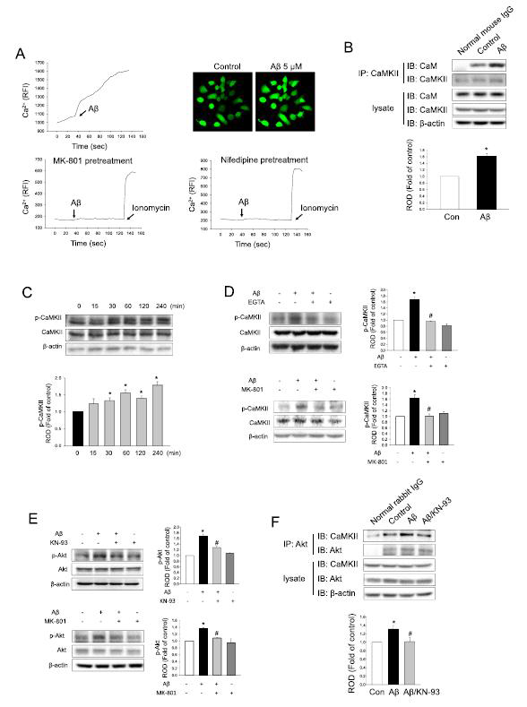 아밀로이드 베타에 의한 칼슘 유입이 Akt 신호전달에 주는 영향