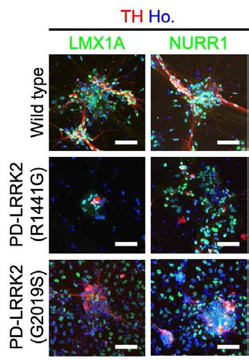 iDP의 중뇌특이적 도파민성 신경세포로의 분화 확인