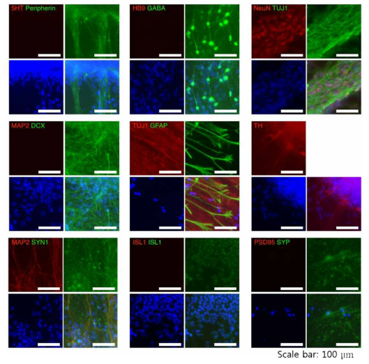 ICC for various neural lineage markers; spontaneous diffrentiation of iNSCs