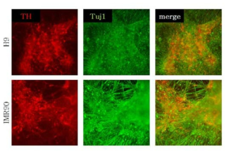 Expression of dopaminergic neuron marker using new method